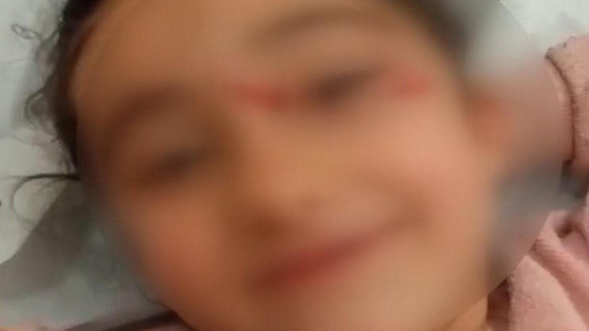 Eyüpsultan'da Sokak Köpekleri 6 Yaşındaki Çocuğa Saldırdı